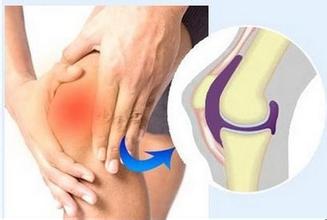 刮风下雨膝关节酸痛，怎么辨别膝关节炎